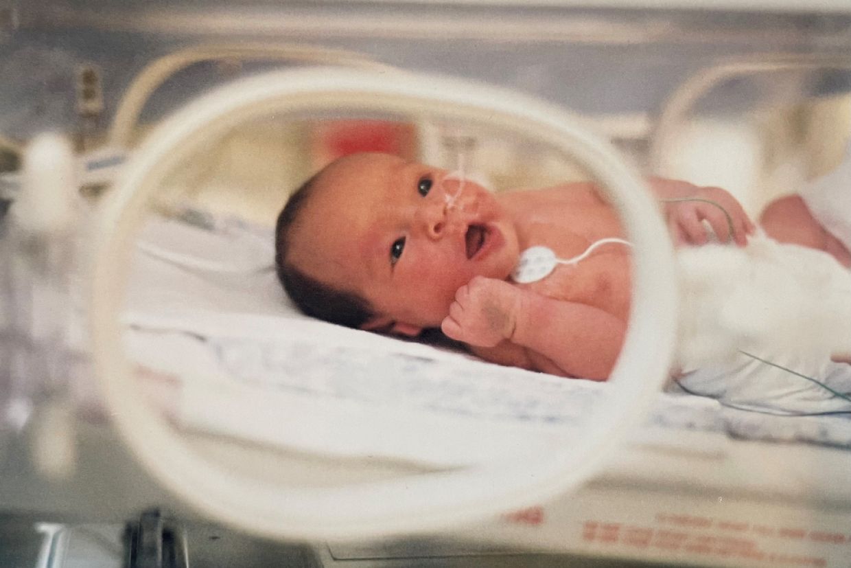 A premature baby in the hospital
